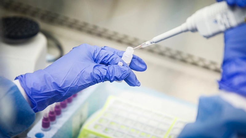 Coronavirus-Test1